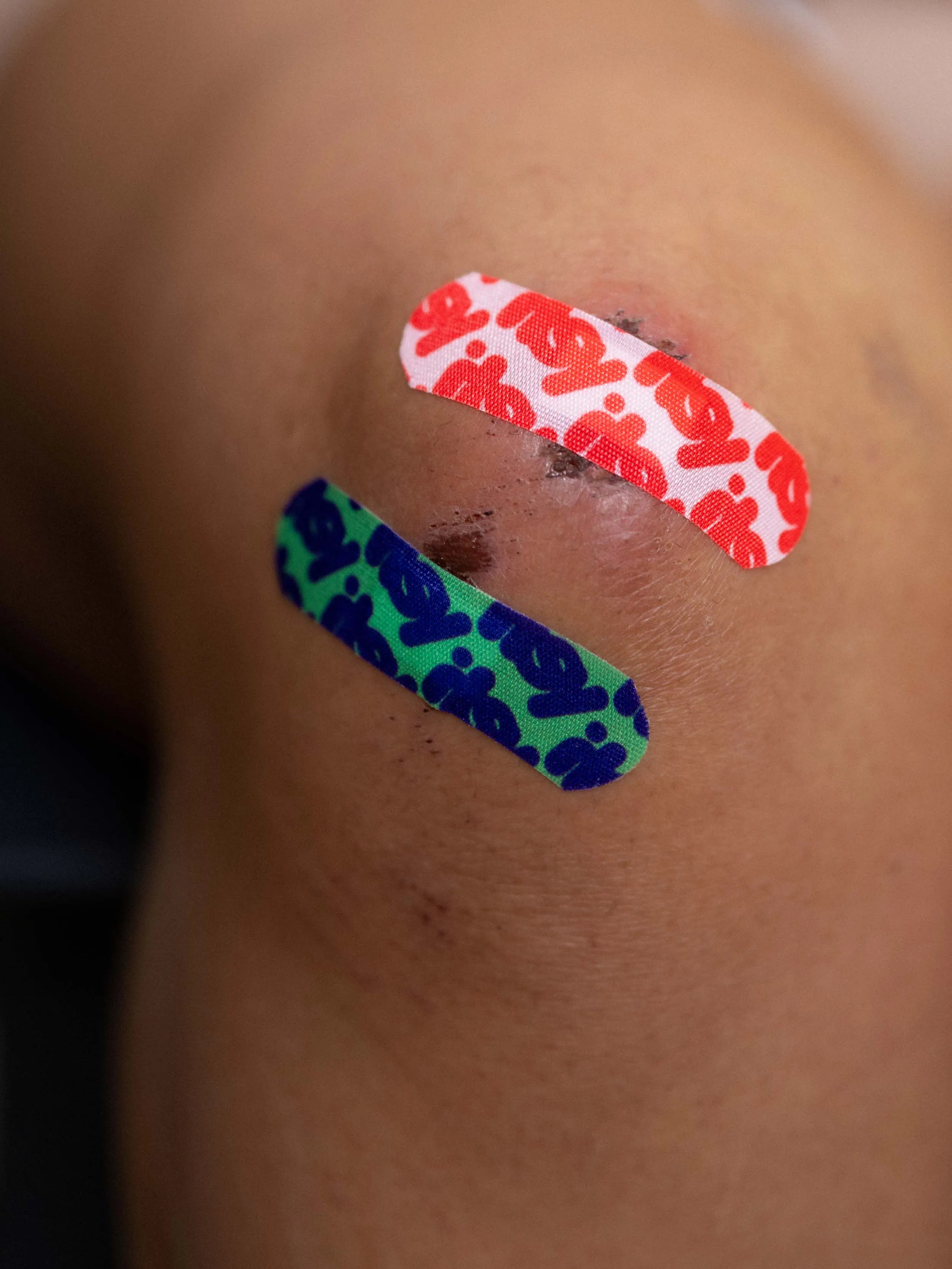 Two itsy fabric bandages, one red and white and one green and navy, worn side by side over a scraped knee